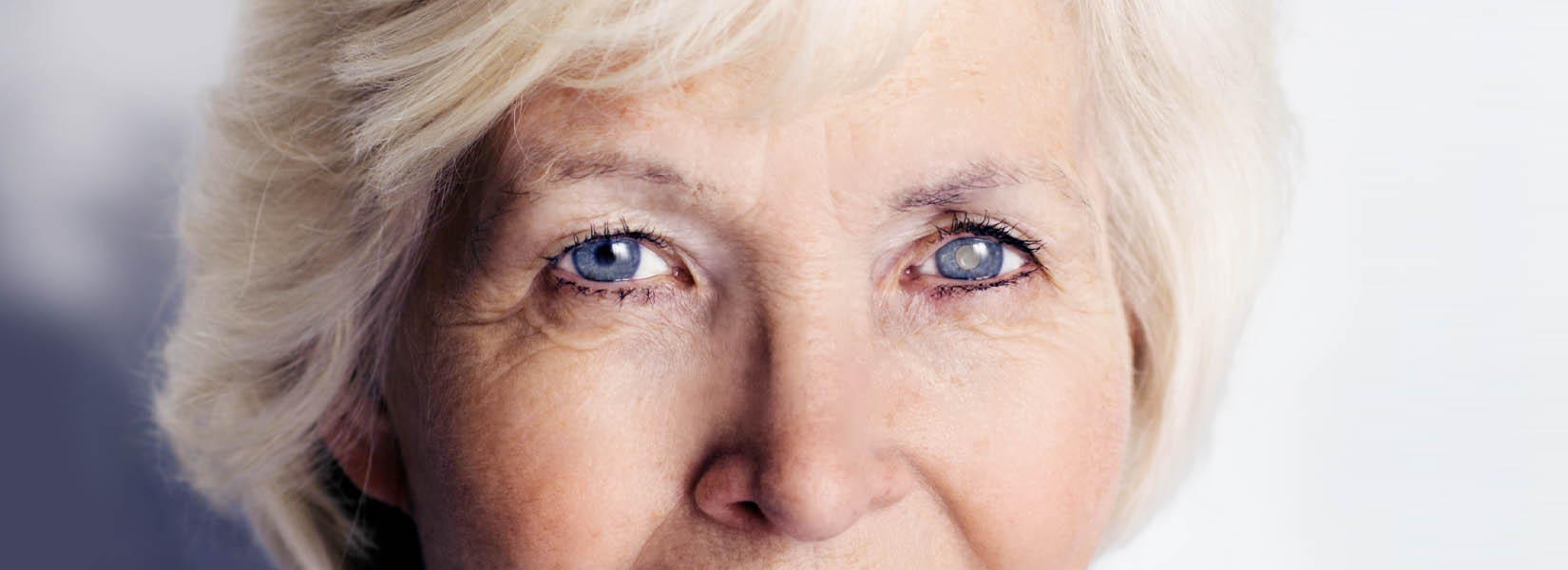 Cataract Surgery in Northeast Colorado Springs